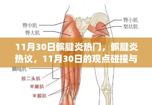 11月30日髌腱炎热议与个人立场,观点碰撞与髌腱炎的关注度