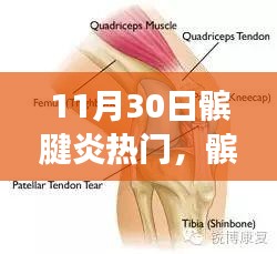 11月30日髌腱炎热议与个人立场,观点碰撞与髌腱炎的关注度