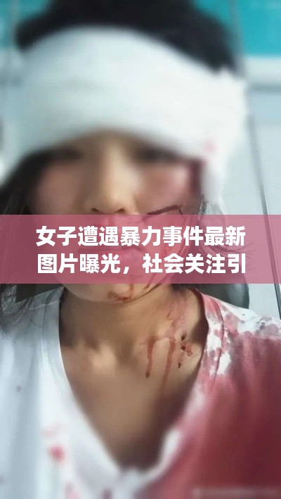 女子遭遇暴力事件最新图片曝光,社会关注引发正义呼声