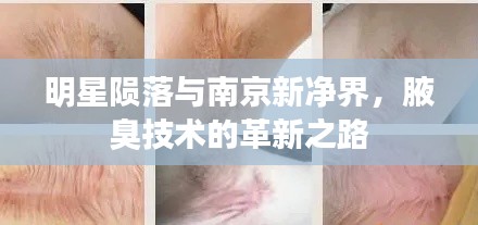 明星陨落与南京新净界,腋臭技术的革新之路