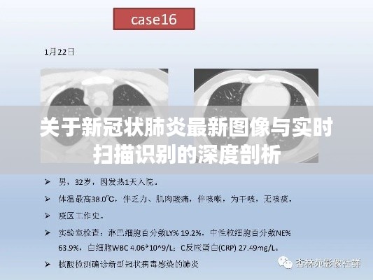 关于新冠状肺炎最新图像与实时扫描识别的深度剖析