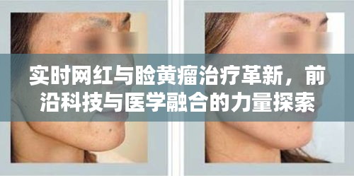 实时网红与睑黄瘤治疗革新,前沿科技与医学融合的力量探索
